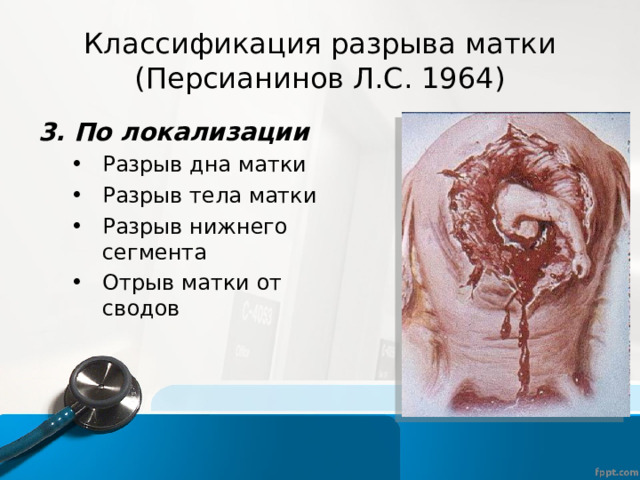 Классификация разрыва матки (Персианинов Л.С. 1964) 3. По локализации Разрыв дна матки Разрыв тела матки Разрыв нижнего сегмента Отрыв матки от сводов Разрыв дна матки Разрыв тела матки Разрыв нижнего сегмента Отрыв матки от сводов 