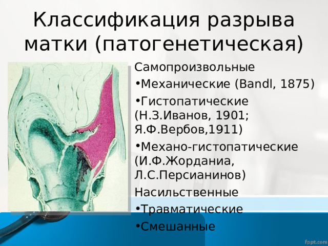 Классификация разрыва матки (патогенетическая) Самопроизвольные Механические (Bandl, 1875) Гистопатические (Н.З.Иванов, 1901; Я.Ф.Вербов,1911) Механо-гистопатические (И.Ф.Жорданиа, Л.С.Персианинов) Насильственные Травматические Смешанные 