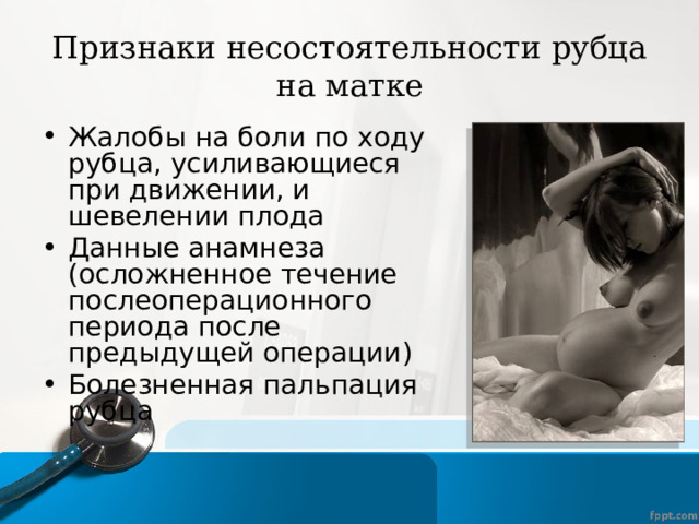Признаки несостоятельности рубца на матке Жалобы на боли по ходу рубца, усиливающиеся при движении, и шевелении плода Данные анамнеза (осложненное течение послеоперационного периода после предыдущей операции) Болезненная пальпация рубца  