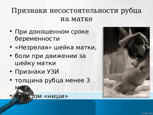 Признаки несостоятельности рубца на матке При доношенном сроке беременности «Незрелая» шейка матки, боли при движении за шейку матки Признаки УЗИ толщина рубца менее 3 мм симптом «ниши»  