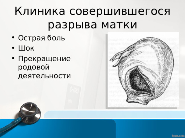 Клиника совершившегося разрыва матки Острая боль Шок Прекращение родовой деятельности  