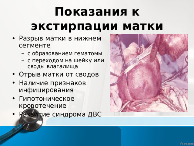 Показания к экстирпации матки Разрыв матки в нижнем сегменте с образованием гематомы с переходом на шейку или своды влагалища с образованием гематомы с переходом на шейку или своды влагалища Отрыв матки от сводов Наличие признаков инфицирования Гипотоническое кровотечение Развитие синдрома ДВС 