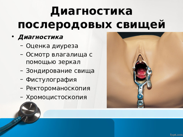 Диагностика послеродовых свищей Диагностика Оценка диуреза Осмотр влагалища с помощью зеркал Зондирование свища Фистулография Ректороманоскопия Хромоцистоскопия Оценка диуреза Осмотр влагалища с помощью зеркал Зондирование свища Фистулография Ректороманоскопия Хромоцистоскопия 