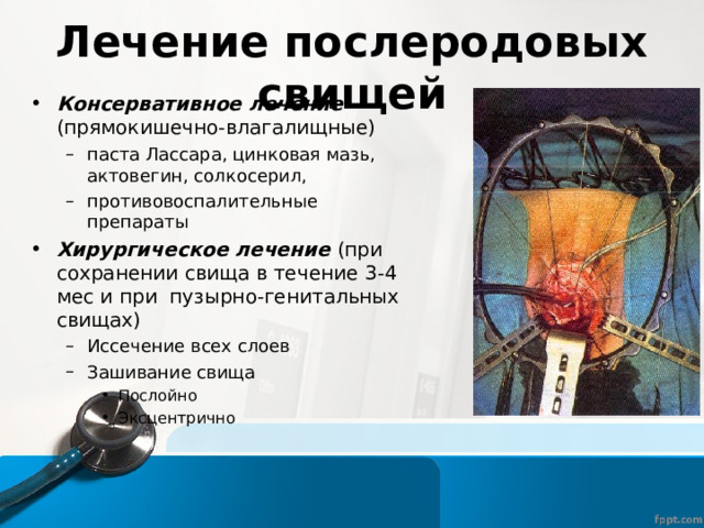 Лечение послеродовых свищей Консервативное лечение (прямокишечно-влагалищные) паста Лассара, цинковая мазь, актовегин, солкосерил, противовоспалительные препараты паста Лассара, цинковая мазь, актовегин, солкосерил, противовоспалительные препараты Хирургическое лечение (при сохранении свища в течение 3-4 мес и при пузырно-генитальных свищах) Иссечение всех слоев Зашивание свища Послойно Эксцентрично Иссечение всех слоев Зашивание свища Послойно Эксцентрично Послойно Эксцентрично 