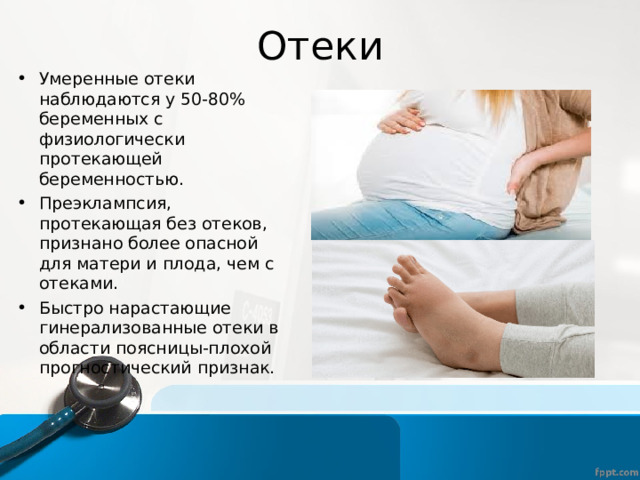 Отеки Умеренные отеки наблюдаются у 50-80% беременных с физиологически протекающей беременностью. Преэклампсия, протекающая без отеков, признано более опасной для матери и плода, чем с отеками. Быстро нарастающие гинерализованные отеки в области поясницы-плохой прогностический признак. 