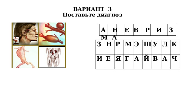 ВАРИАНТ 3  Поставьте диагноз А Н Е В Р И З М А З Н И Е Р М Я Г Э Щ А У Й Л В К А Ч 