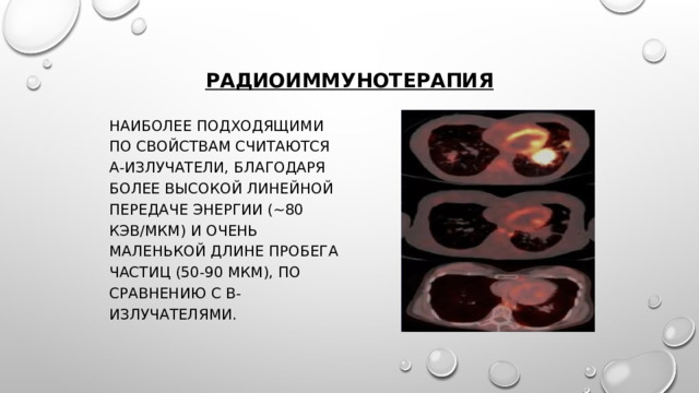 Радиоиммунотерапия Наиболее подходящими по свойствам считаются α-излучатели, благодаря более высокой линейной передаче энергии (~80 кэВ/мкм) и очень маленькой длине пробега частиц (50-90 мкм), по сравнению с β-излучателями. 