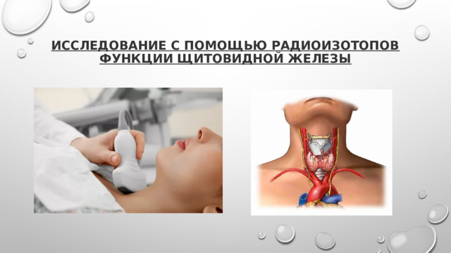 исследование с помощью радиоизотопов функции щитовидной железы 