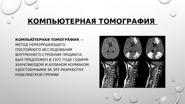 Компьютерная томография Компью́терная  томогра́фия — метод неразрушающего послойного исследования внутреннего строения предмета, был предложен в 1972 году Годфри Хаунсфилдом и Алланом Кормаком, удостоенными за эту разработку Нобелевской премии 