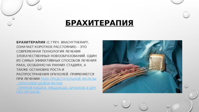 Брахитерапия Брахитерапия (с греч. Brachytherapy, означает короткое расстояние) – это современная технология лечения злокачественных новообразований. Один из самых эффективных способов лечения рака, особенно на ранних стадиях, а также остановке роста и распространения опухолей. Применяется при лечении рака предстательной железы , опухолей шейки матки , прямой кишки, пищевода, бронхов и других органов. 