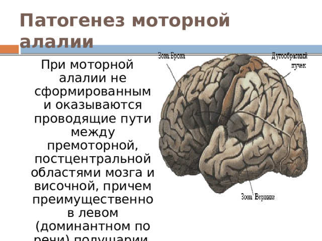 Патогенез моторной алалии При моторной алалии не сформированными оказываются проводящие пути между премоторной, постцентральной областями мозга и височной, причем преимущественно в левом (доминантном по речи) полушарии. 