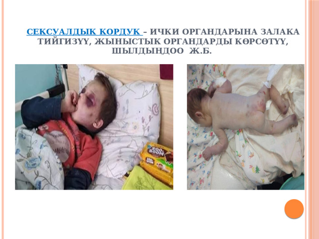 Сексуалдык кордук – ички органдарына залака тийгизүү, жыныстык органдарды көрсөтүү, шылдыңдоо ж.б. 
