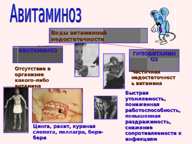 Виды витаминной недостаточности АВИТАМИНОЗ  ГИПОВИТАМИНОЗ  Отсутствие в организме какого-либо витамина Частичная недостаточность витамина Быстрая утомляемость, пониженная работоспособность, повышенная раздражимость, снижение сопротивляемости к инфекциям Цинга, рахит, куриная слепота, пеллагра, бери-бери 