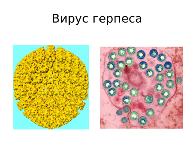 Вирус герпеса 