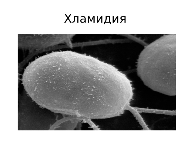 Хламидия 