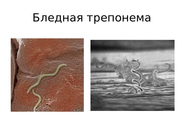 Бледная трепонема 