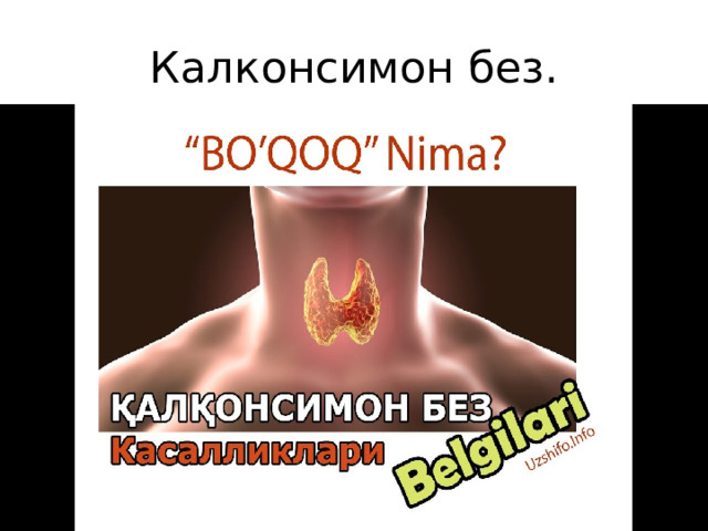 Калконсимон без. 