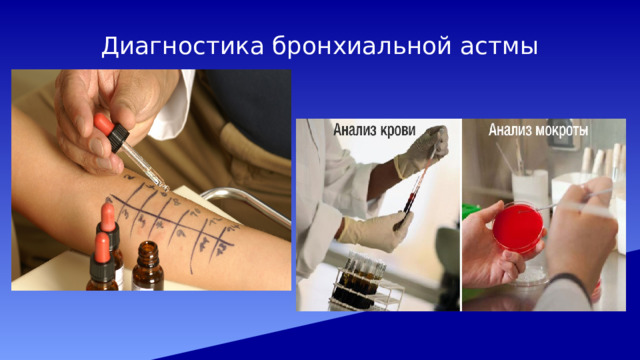 Диагностика бронхиальной астмы 