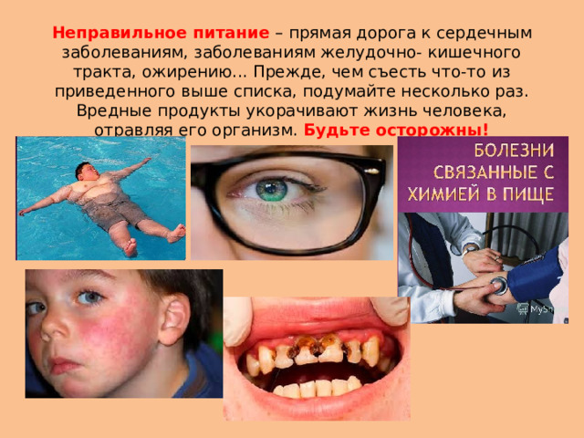Неправильное питание – прямая дорога к сердечным заболеваниям, заболеваниям желудочно- кишечного тракта, ожирению... Прежде, чем съесть что-то из приведенного выше списка, подумайте несколько раз. Вредные продукты укорачивают жизнь человека, отравляя его организм. Будьте осторожны!   
