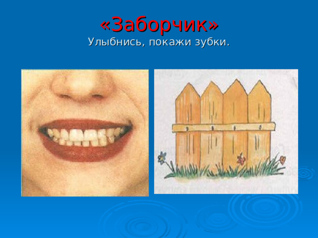 «Заборчик»  Улыбнись, покажи зубки. 
