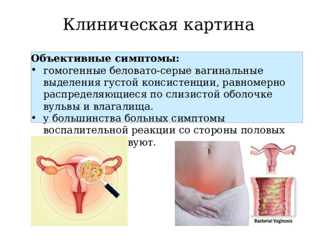 Клиническая картина Объективные симптомы: гомогенные беловато-серые вагинальные выделения густой консистенции, равномерно распределяющиеся по слизистой оболочке вульвы и влагалища. у большинства больных симптомы воспалительной реакции со стороны половых органов отсутствуют.  