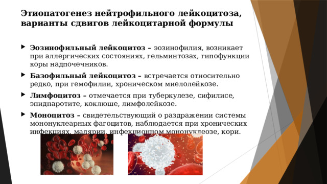 Этиопатогенез нейтрофильного лейкоцитоза, варианты сдвигов лейкоцитарной формулы Эозинофильный лейкоцитоз – эозинофилия, возникает при аллергических состояниях, гельминтозах, гипофункции коры надпочечников. Базофильный лейкоцитоз – встречается относительно редко, при гемофилии, хроническом миелолейкозе. Лимфоцитоз – отмечается при туберкулезе, сифилисе, эпидпаротите, коклюше, лимфолейкозе. Моноцитоз – свидетельствующий о раздражении системы мононуклеарных фагоцитов, наблюдается при хронических инфекциях, малярии, инфекционном мононуклеозе, кори. 