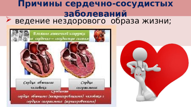 Причины сердечно-сосудистых заболеваний  ведение нездорового образа жизни; 