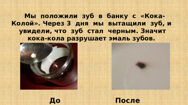  Мы положили зуб в банку с «Кока-Колой». Через 3 дня мы вытащили зуб, и увидели, что зуб стал черным. Значит кока-кола разрушает эмаль зубов. До После 