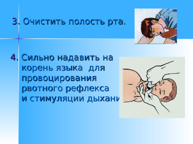 Что делать в первые секунды после извлечения утонувшего из воды: 1. Перевернуть  пострадавшего  на живот. 2.  