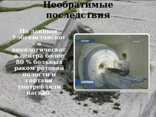 Необратимые последствия    По данным Узбекистанского онкологического центра более 80 % больных раком ротовой полости и гортани употребляли насвай.   