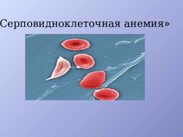 «Серповидноклеточная анемия »   