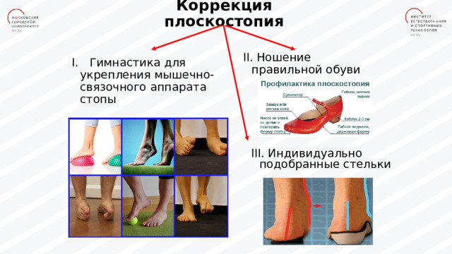 Коррекция плоскостопия II . Ношение правильной обуви I. Гимнастика для укрепления мышечно-связочного аппарата стопы III. Индивидуально подобранные стельки 