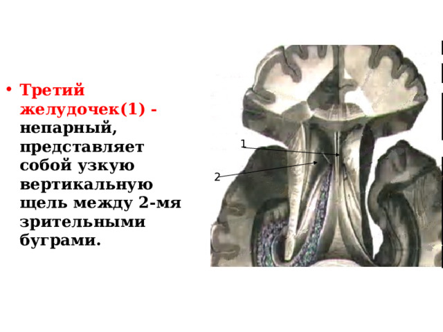 Третий желудочек(1) - непарный, представляет собой узкую вертикальную щель между 2-мя зрительными буграми. 1 2 