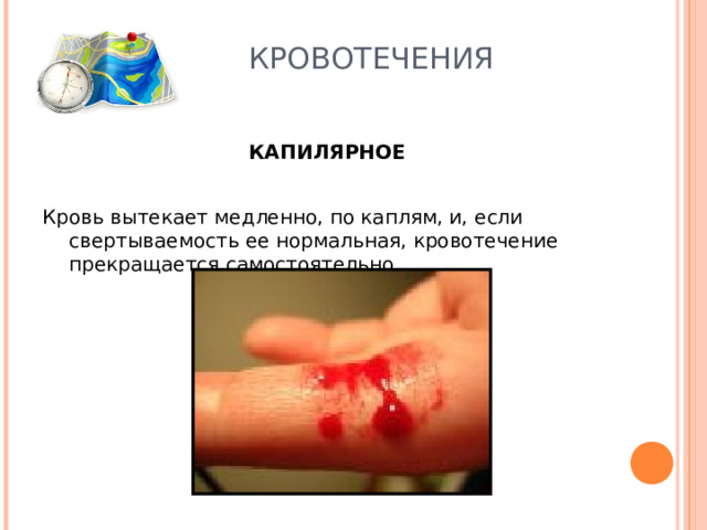 КРОВОТЕЧЕНИЯ КАПИЛЯРНОЕ Кровь вытекает медленно, по каплям, и, если свертываемость ее нормальная, кровотечение прекращается самостоятельно Кровь вытекает медленно, по каплям, и, если свертываемость ее нормальная, кровотечение прекращается самостоятельно 