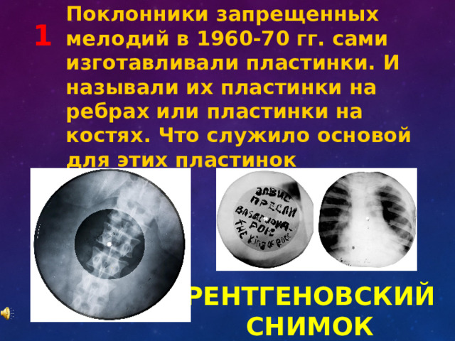 Поклонники запрещенных мелодий в 1960-70 гг. сами изготавливали пластинки. И называли их пластинки на ребрах или пластинки на костях. Что служило основой для этих пластинок 1 РЕНТГЕНОВСКИЙ СНИМОК 