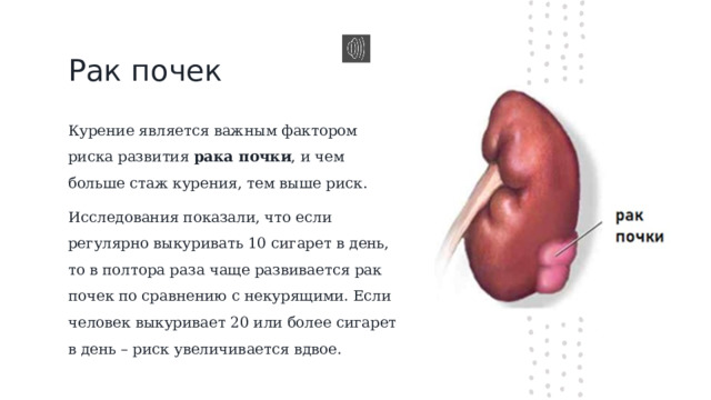 Рак почек Курение является важным фактором риска развития  рака почки , и чем больше стаж курения, тем выше риск. Исследования показали, что если регулярно выкуривать 10 сигарет в день, то в полтора раза чаще развивается рак почек по сравнению с некурящими. Если человек выкуривает 20 или более сигарет в день – риск увеличивается вдвое. 
