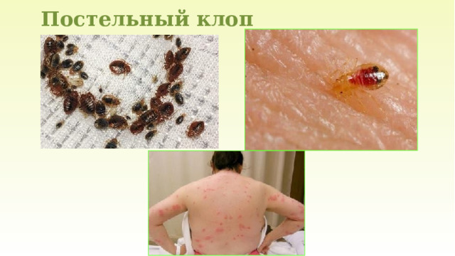 Постельный клоп 