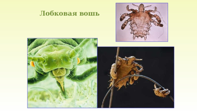 Лобковая вошь 