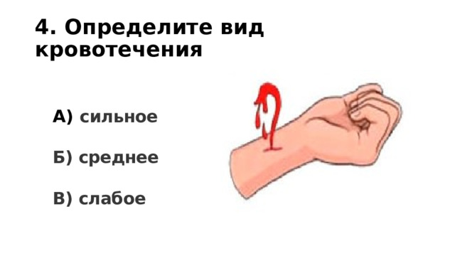 4. Определите вид кровотечения А) сильное  Б) среднее  В) слабое 