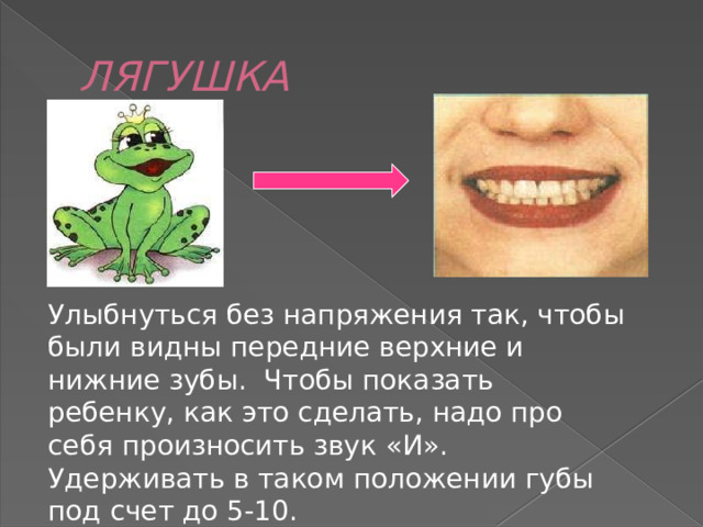 ЛЯГУШКА Улыбнуться без напряжения так, чтобы были видны передние верхние и нижние зубы. Чтобы показать ребенку, как это сделать, надо про себя произносить звук «И». Удерживать в таком положении губы под счет до 5-10. 