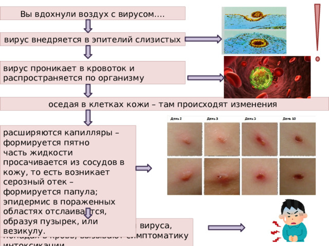 Вы вдохнули воздух с вирусом…. вирус внедряется в эпителий слизистых вирус проникает в кровоток и распространяется по организму оседая в клетках кожи – там происходят изменения расширяются капилляры – формируется пятно часть жидкости просачивается из сосудов в кожу, то есть возникает серозный отек – формируется папула; эпидермис в пораженных областях отслаивается, образуя пузырек, или везикулу. Продукты жизнедеятельности вируса, попадая в кровь, вызывают симптоматику интоксикации 