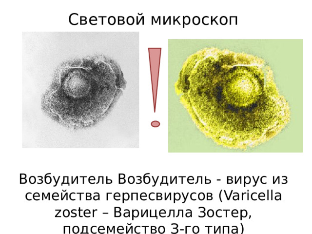 Световой микроскоп Возбудитель Возбудитель - вирус из семейства герпесвирусов (Varicella zoster – Варицелла Зостер, подсемейство З-го типа) 