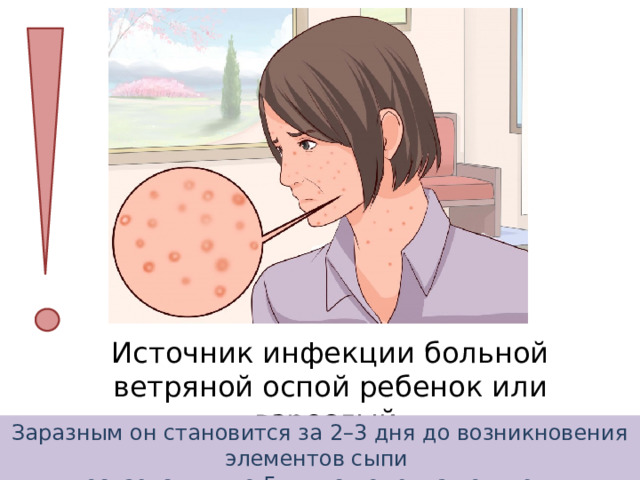 Источник инфекции больной ветряной оспой ребенок или взрослый Заразным он становится за 2–3 дня до возникновения элементов сыпи и остается им до 5 дня с момента появления последнего элемента сыпи 