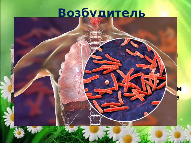 Возбудитель заболевания Возбудитель заболевания – Микобактерия туберкулеза (МБТ) – была открыта Робертом Кохом в 1882 году, ее назвали “палочкой Коха” 