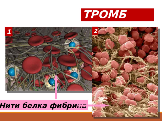 ТРОМБ 2 1 Нити белка фибрина 