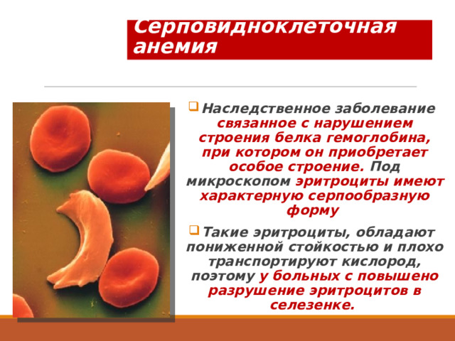 Серповидноклеточная анемия Наследственное заболевание связанное с нарушением строения белка гемоглобина, при котором он приобретает особое строение. Под микроскопом эритроциты имеют характерную серпообразную форму Такие эритроциты, обладают пониженной стойкостью и плохо транспортируют кислород, поэтому у больных с повышено разрушение эритроцитов в селезенке. 
