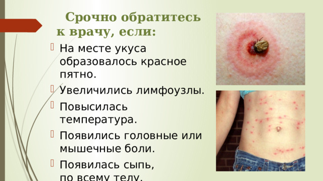  Срочно обратитесь к врачу, если: На месте укуса образовалось красное пятно. Увеличились лимфоузлы. Повысилась температура. Появились головные или мышечные боли. Появилась сыпь, по всему телу. 