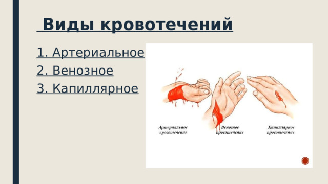  Виды кровотечений 1. Артериальное 2. Венозное 3. Капиллярное 