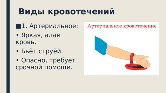  Виды кровотечений 1. Артериальное: • Яркая, алая кровь. • Бьёт струёй. • Опасно, требует срочной помощи.   