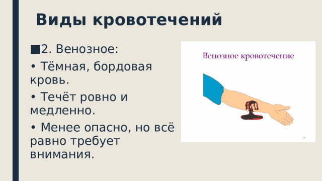  Виды кровотечений 2. Венозное: • Тёмная, бордовая кровь. • Течёт ровно и медленно. • Менее опасно, но всё равно требует внимания. 